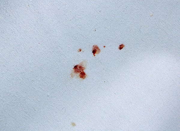 Кровь на простыне после раздавленных личинок клопа