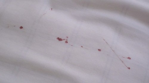 Следы крови на постельном белье от раздавленных личинок клопов